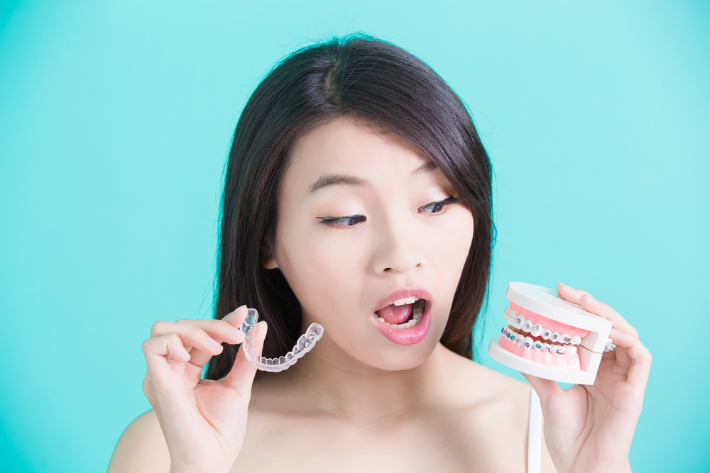 Invisalign vs. braces comparison illustration.
