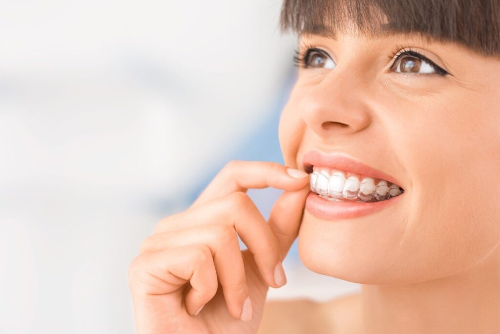 Frequently Asked Questions About Invisalign