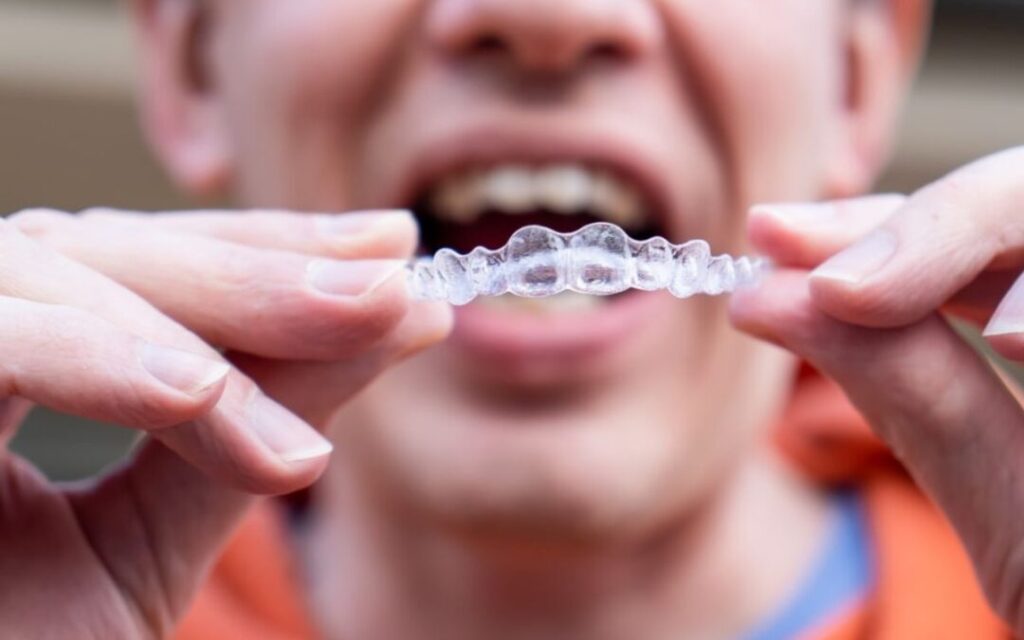 Advantages of Invisalign for Orthodontic Treatment Compared to Metalic or ceramic braces