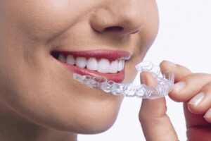 woman putting on invisalign aligners
