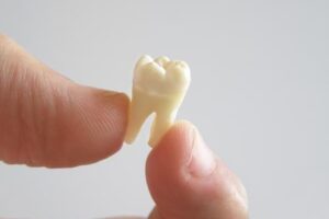 wisdom tooth