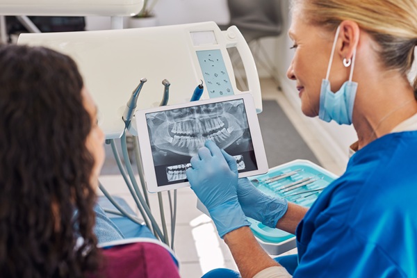 How Emergency Dentists Perform A Root Canal Retreatment